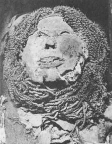 Mumie der Henettaui, deren Haut an vielen Stellen geplatzt ist (um 1000 v. Chr.)